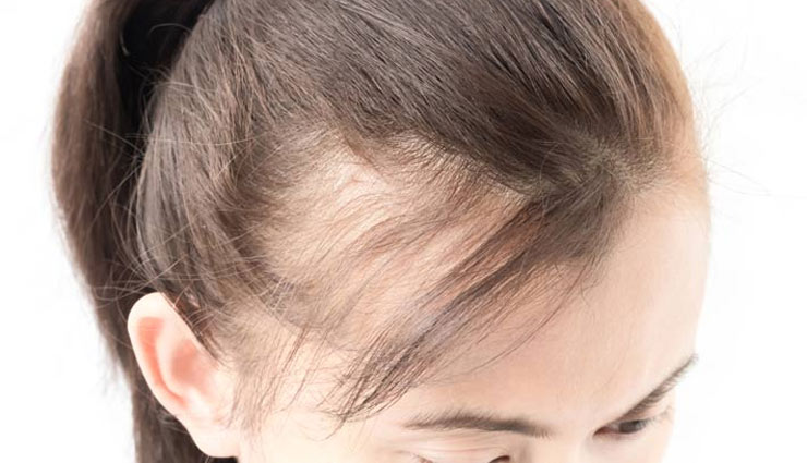 अनार से जुड़े हैं सेहत के तार, हर बीमारी में हमें संभालकर फिर से कर देता है मजबूती से खड़ा! pomegranate,pomegranate remedy,vitamin,pomegranate health,pomegranate doctor,immunity,anemia,thirst,cancer,baldness,health article in hindi