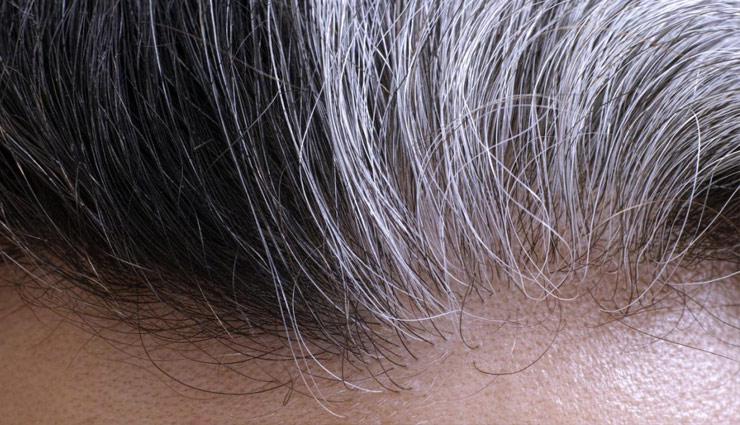 bhringraj oil,bhringraj tail,hair,bhringraj oil hair,bhringraj tail hair,dandruff,baldness,grey hair,health news in hindi,beauty news in hindi