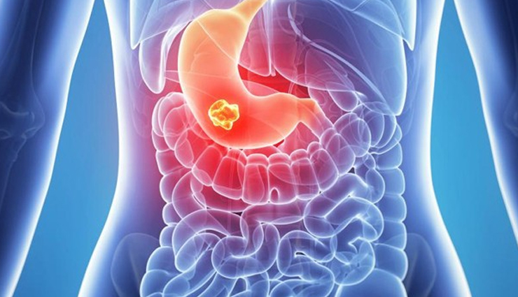 abdominal pain,symptoms,causes,diagnosis,treatment,prevention,stomach pain,gastrointestinal disorders,abdominal discomfort,digestive system issues