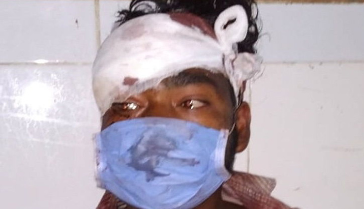 भागलपुर सड़क हादसा / ट्रक ने बस को मारी टक्कर, 9 लोगों की हुई मौत, बस सवार ने सुनाई दर्द भरी दास्तां
