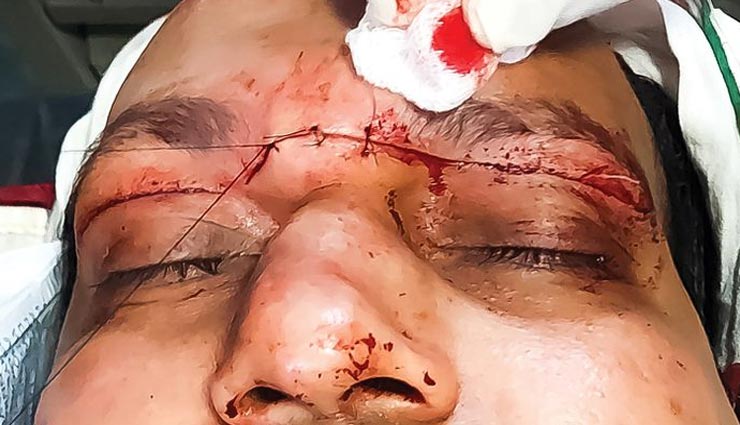 जयपुर : पतंग का मांझा बढ़ा रहा राहगीरों की मुश्किलें, लगातार हो रहे हादसे