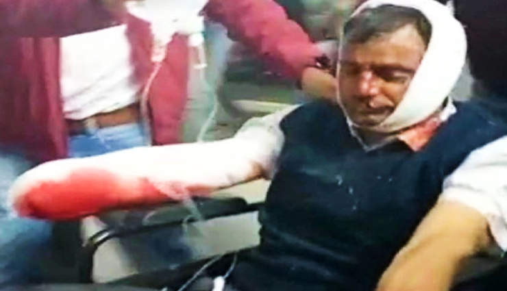 उदयपुर : दिनदहाड़े युवक ने तलवार से काटा पत्नी के प्रेमी के पिता का हाथ, पुलिस हिरासत में आरोपी
