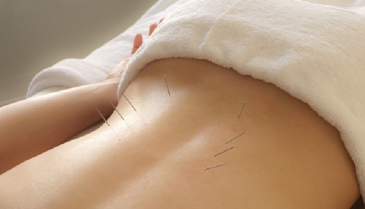 home remedies for back pain relief,natural remedies for treating back pain,back pain relief at home,remedies for back pain management,treating back pain naturally,back pain home treatment options,diy remedies for back pain relief,back pain relief techniques,home remedies for lower back pain,effective home treatments for back pain,back pain remedies you can try at home,natural ways to alleviate back pain,managing back pain with home remedies,tips for relieving back pain at home,holistic approaches to back pain relief,back pain home care solutions,quick relief for back pain at home,herbal remedies for back pain,essential oils for back pain relief,acupuncture for treating back pain