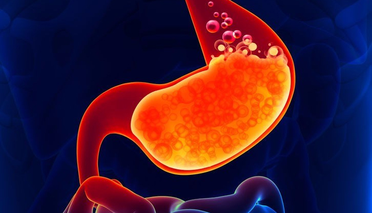 15 Foods to Help You Fight Acidity and Find Relief