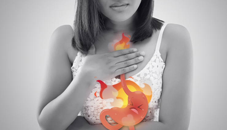 5 Ways To Get Relief From Acidity