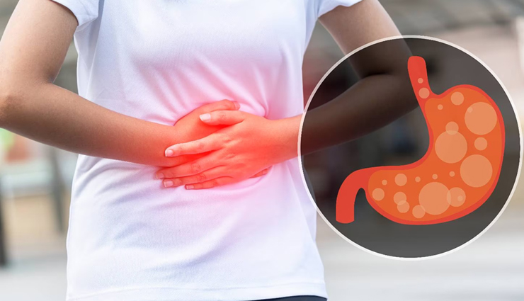 10 Effective Home Remedies To Treat Acid Reflux