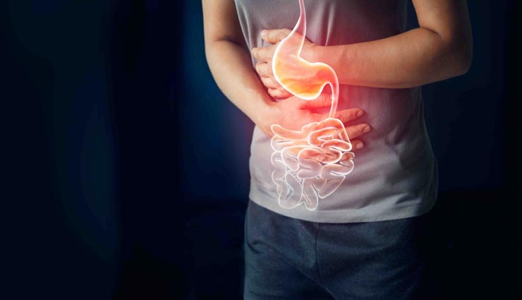 इन घरेलू नुस्खों से तुरंत दूर होगी एसिडिटी की समस्या, आजमाते ही मिलेगी राहत