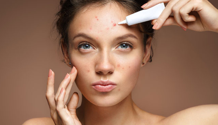 6 Quick Remedies To Get Rid of Pimples