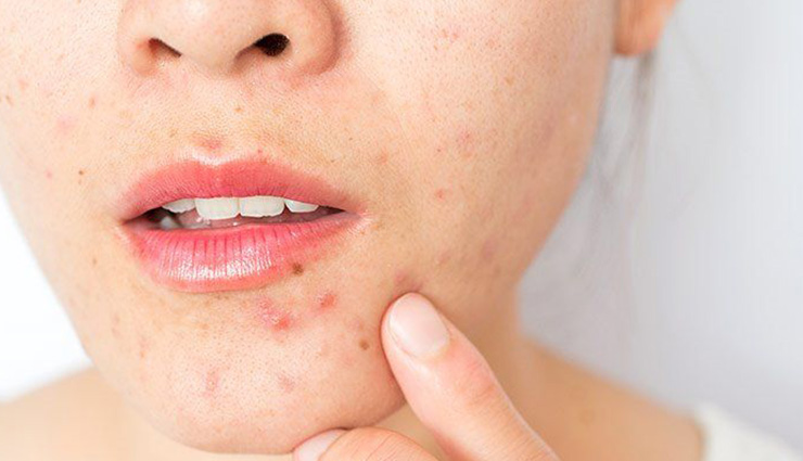 skin pcommon skin problems home remedies,home remedies for skin issues,most common skin problems,natural solutions for skin problems,home remedies for acne,home remedies for eczema,treating skin problems at home,diy skin treatments,natural skin care tips,common skin conditions home remediesroblems