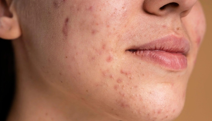 black gram benefits,urad dal health benefits,black gram for skin,urad dal for hair growth,natural skin exfoliant,black gram face pack,urad dal uses,protein-rich dal,benefits of urad dal,natural hair care,skin care with black gram,indian home remedies,urad dal powder for skin,healthy hair tips,glowing skin home remedies