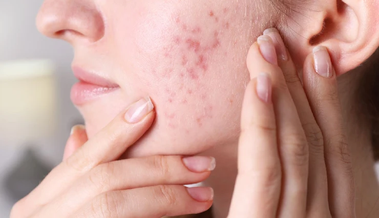 rose petals skincare,beauty benefits of roses,natural skin toner,rose petal facial,rose for glowing skin,rose water benefits,herbal skincare ingredients,natural beauty remedies,calming skincare,rose in beauty routine