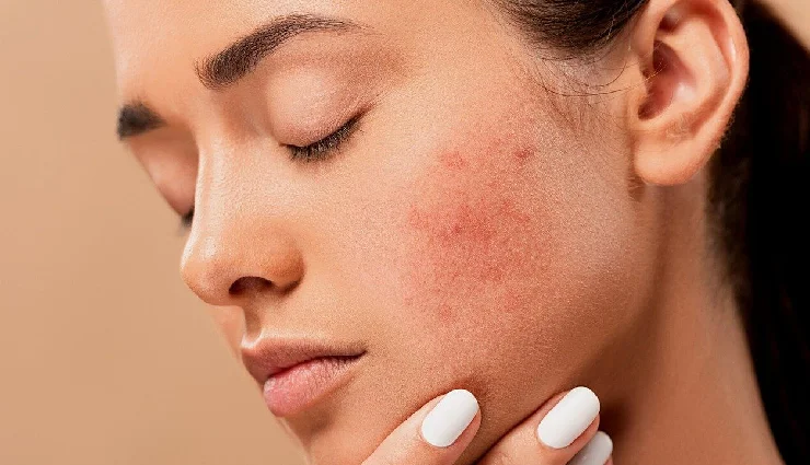 coconut water for skin,coconut water for hair,coconut water beauty benefits,coconut water for acne,coconut water for dandruff,coconut water glow,coconut water hydration,coconut water hair care,coconut water diy remedies,coconut water skincare tips