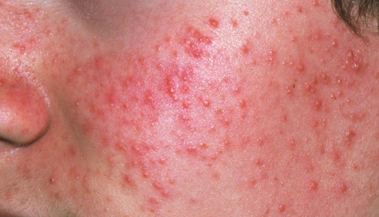 peppermint benefits for skin,peppermint oil skincare benefits,peppermint extract for healthy skin,peppermint properties for skin,natural skincare with peppermint,peppermint essential oil benefits,refreshing peppermint skincare,peppermint-infused skin products,peppermint skin treatments,peppermint for clear skin