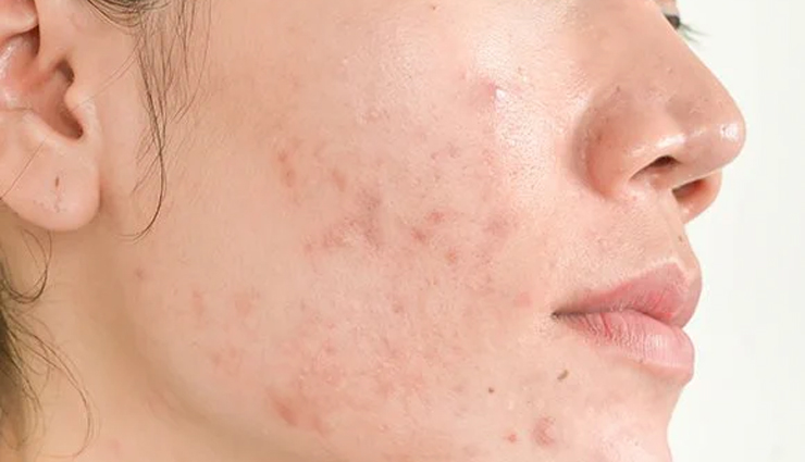 cod liver oil benefits for skin,cod liver oil for skincare,omega-3 fatty acids skin benefits,vitamin a skin care,natural skin moisturization,anti-inflammatory skin treatment,collagen production,acne reduction remedy,protection from sun damage,wound healing with cod liver oil