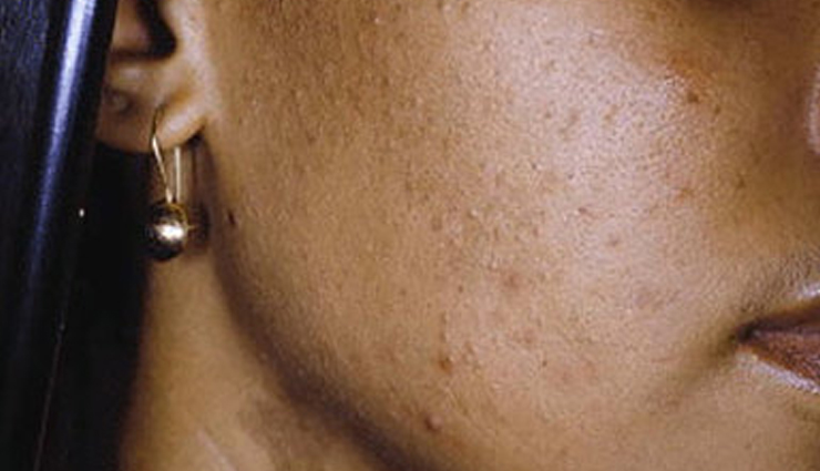 diy giloy uses,giloy for skin,giloy for hair,giloy beauty benefits,how to use giloy,giloy face mask,giloy hair treatment