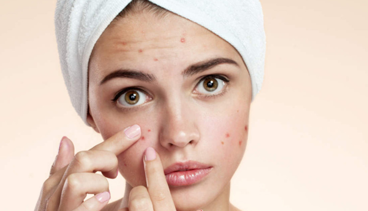 castor oil,castor oil for skin,castor oil for hair,beauty benefits of castor oil,castor oil good for skin,castor oil good for hair,skin care tips,hair care tips,skin beauty,hair beauty,beauty,beauty tips