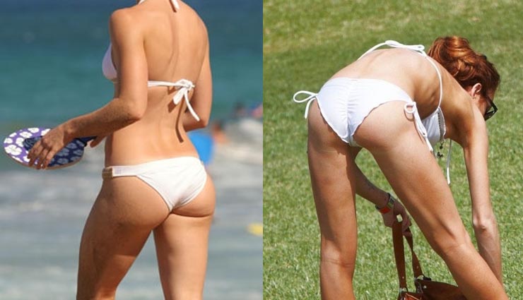 tips to get rid of acne on butt,butt acne,skin care tips,beauty tips