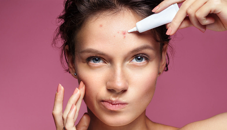  5 DIY Face Masks To Get of Acne