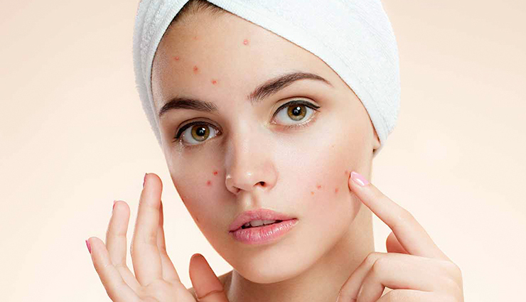 DIY Oatmeal and Honey To Control Your Acne Problem