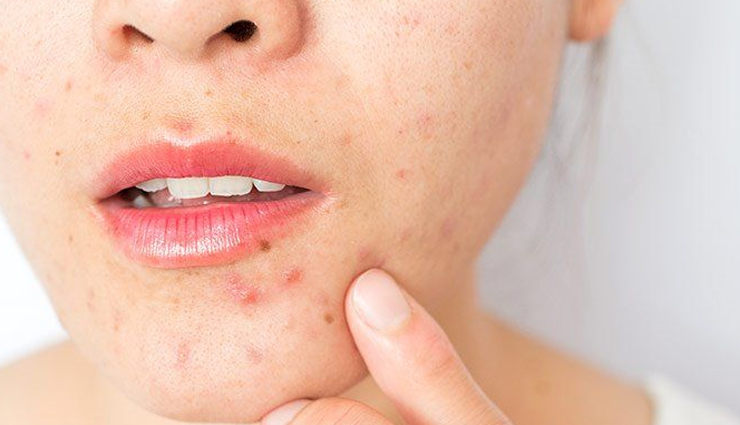 squalane oil benefits for skin,squalane oil uses for skin,squalane oil side effects,benefits of using squalane oil for skin,squalane oil skincare benefits,squalane oil for skin care,squalane oil benefits and uses,squalane oil side effects on skin,squalane oil for skin hydration,natural squalane oil benefits for skin,squalane oil anti-aging effects,squalane oil for sensitive skin,squalane oil acne treatment,squalane oil for dry skin,squalane oil skin moisturizer,organic squalane oil benefits for skin,squalane oil skin protection,squalane oil for skin elasticity,potential side effects of squalane oil on skin,squalane oil skin care tips