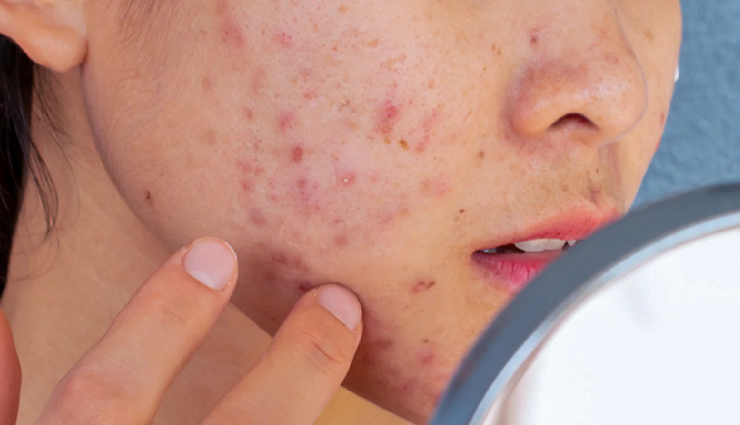 vitamin d deficiency skin issues,skin problems from lack of vitamin d,effects of vitamin d deficiency on skin,vitamin d deficiency and skin conditions,signs of vitamin d deficiency in skin,skin diseases caused by vitamin d deficiency,vitamin d deficiency-related skin disorders,skin ailments linked to vitamin d deficiency,vitamin d deficiency impacts on skin health,vitamin d deficiency skin complications