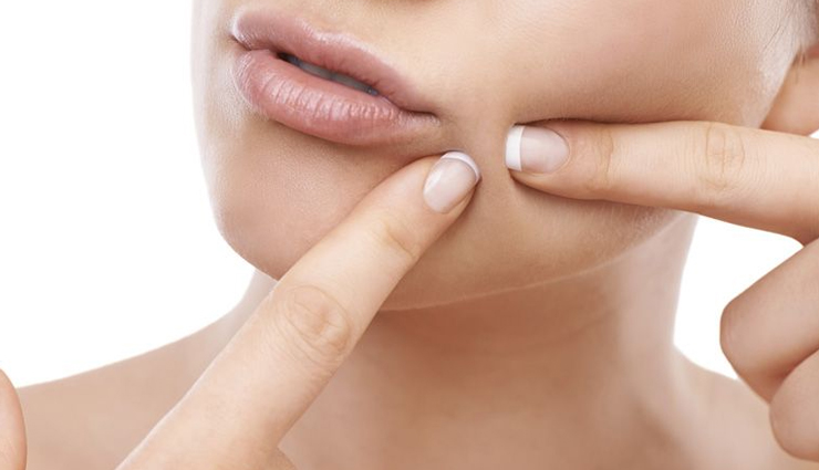 5 DIY Ways To Use Yogurt For Acne Removal