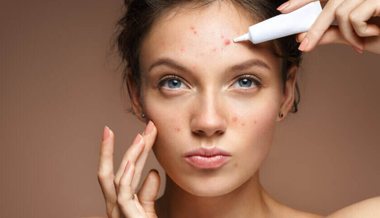 5 Natural Ways To Get Rid of Acne Scars Using Rosehip Oil