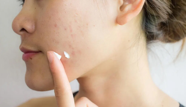 benefits of using turmeric on skin and face,beauty tips,beauty hacks