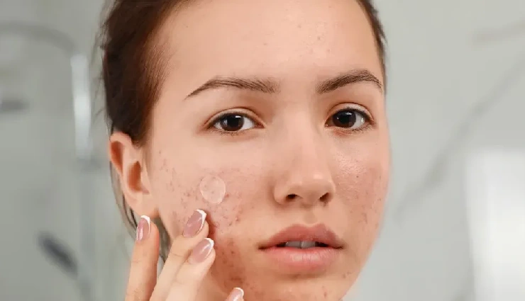 yogurt for skin,yogurt for hair,natural beauty remedies,diy skincare with yogurt,yogurt face mask benefits,yogurt hair mask,how to use yogurt for glowing skin,yogurt for acne and tan,natural hair conditioner,healthy skin and hair tips