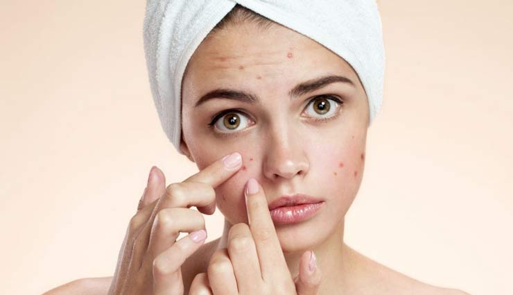 5 Homemade Face Packs To Get Rid of Acne Marks