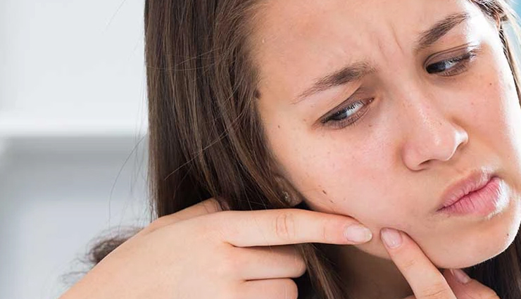 5 Teenage Skin Care Routine Routine For Oily Acne Prone Skin
