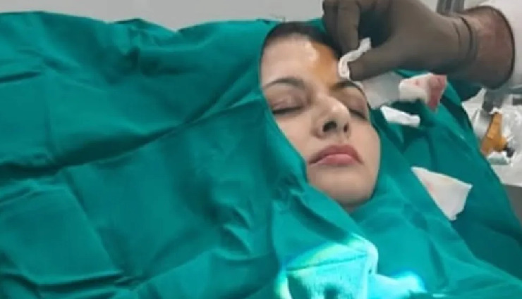 सलमान खान की यह एक्ट्रेस हुई हादसे का शिकार, माथे पर लगे 13 टांके
