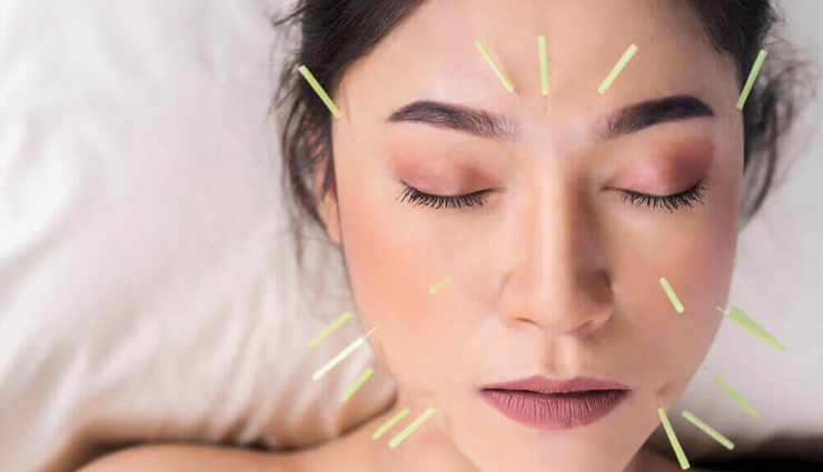 home remedies for migraine relief,natural treatments for migraines,migraine relief without medication,effective remedies for migraines at home,diy migraine treatments,natural migraine remedies,how to treat migraines at home,home-based migraine solutions,alleviating migraines naturally