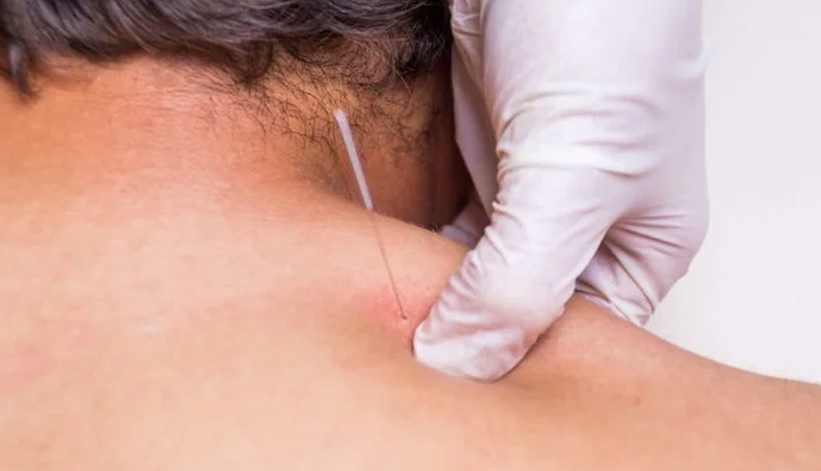 home remedies for neck pain,natural remedies for neck pain,how to get rid of neck pain at home,home remedies for neck stiffness,diy remedies for neck pain,herbal remedies for neck pain,neck pain relief at home,easy home remedies for neck pain,effective home remedies for neck pain,home remedies for chronic neck pain