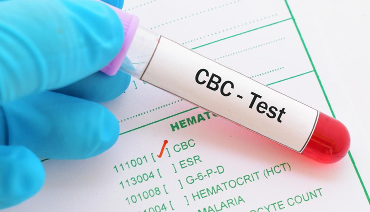 blood tests adults should take,blood tests,adults health tips,Health tips,fitness tips