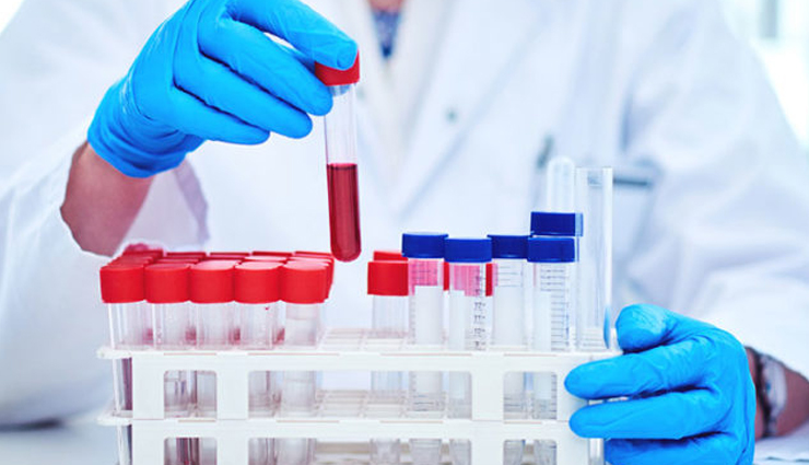 blood tests adults should take,blood tests,adults health tips,Health tips,fitness tips