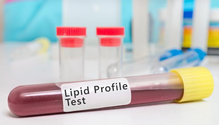 blood tests adults should take,blood tests,adults health tips,Health tips,fitness tips