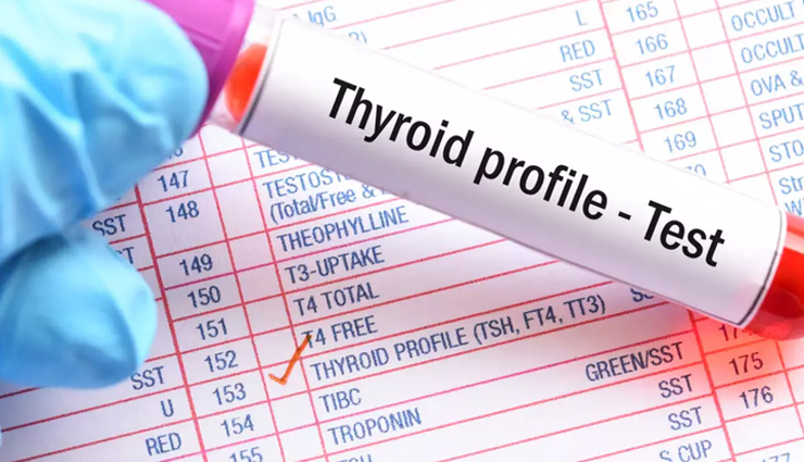 blood tests adults should take,blood tests,adults health tips,Health tips,fitness tips