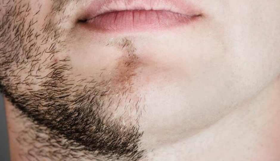8 Home Remedies to Treat Skin After Shaving