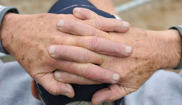 5 Things To Do at Home To Reduce Age Spots