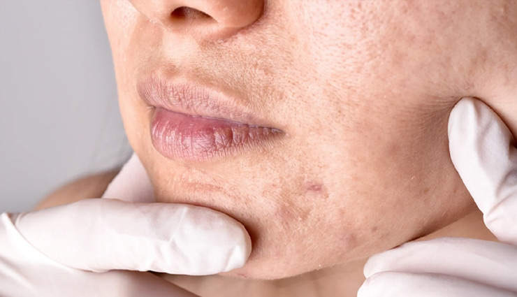 health benefits of bitter gourd,bitter gourd for blood sugar,benefits of bitter melon,bitter melon health benefits,bitter gourd for weight loss,bitter gourd for skin health,bitter gourd for digestion,immune-boosting foods,bitter gourd for liver health,anti-inflammatory foods