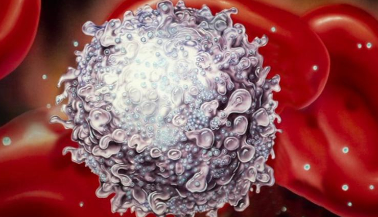 what is hiv and how to prevent it,hiv prevention methods,ways to prevent hiv infection,hiv risk reduction,hiv prevention tips,how to avoid hiv,preventing hiv transmission,safe sex hiv prevention,prep for hiv prevention,hiv testing and prevention