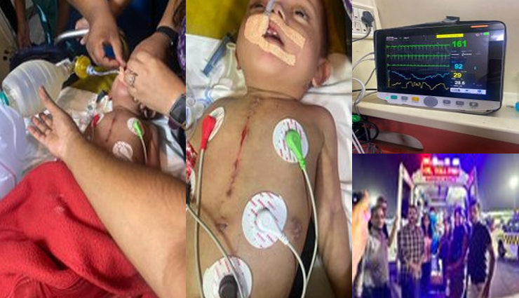 उड़ती फ्लाइट में एम्स के डॉक्टरों का चमत्कार, मृत प्राय: हो चुकी बच्ची की बचाई जान