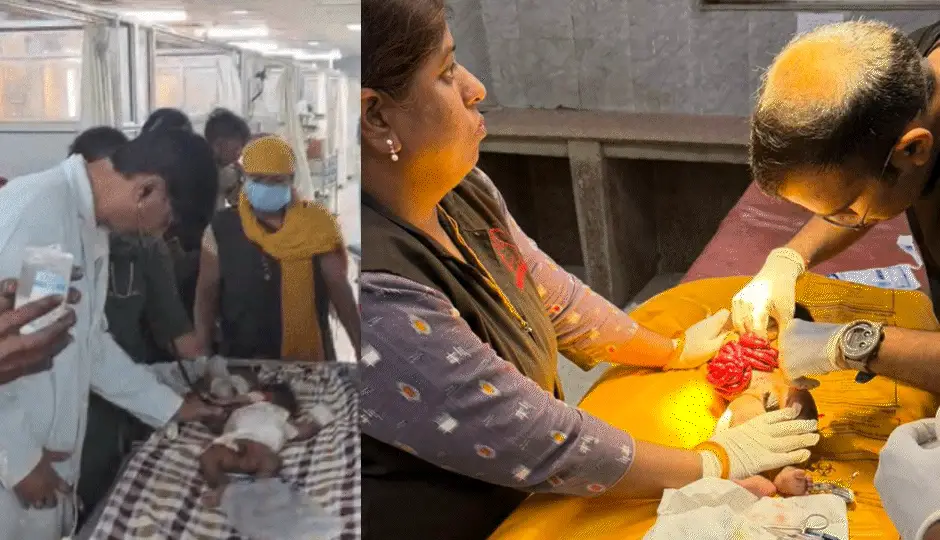 कुत्तों का कहर: डेढ़ महीने के मासूम को नोचा, आंतें बाहर आईं; मां ने 5 मिनट तक संघर्ष कर बच्चे को ढककर बचाई जान