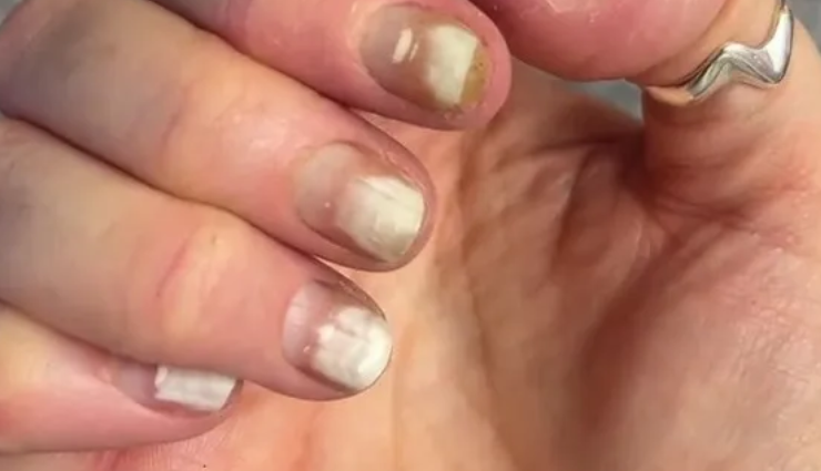 nail polish impact on nails,effects of wearing nail polish,nail polish consequences on nails,what happens to nails with nail polish,nail polish and nail health,nail polish damage to nails,nail enamel impact on nails,consequences of frequent nail polish use,nail polish side effects,nails after prolonged nail polish wear,long-term effects of nail lacquer,health risks of continuous nail polish application,nail polish wear and tear on nails,nail polish residue effects,nail health and polish use consequences