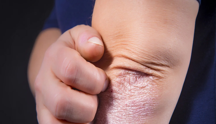 signs to show that your immunity is weak,healthy living,Health tips