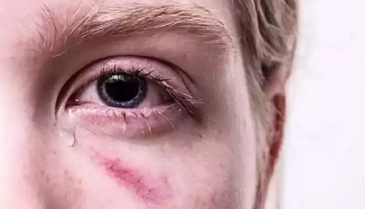 kalonji seeds benefits,black seeds health benefits,nigella sativa seeds advantages,immune system support with kalonji seeds,anti-inflammatory effects of kalonji seeds,digestive health benefits of black seeds,heart health advantages of nigella sativa seeds,diabetes management with kalonji seeds,weight management benefits of black seeds,respiratory health improvement with nigella sativa seeds