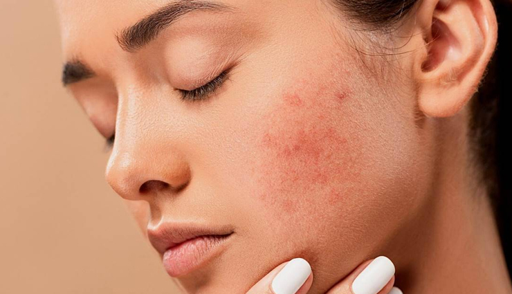 almond face packs,diy face packs,skin care tips,beauty tips,homemade face packs