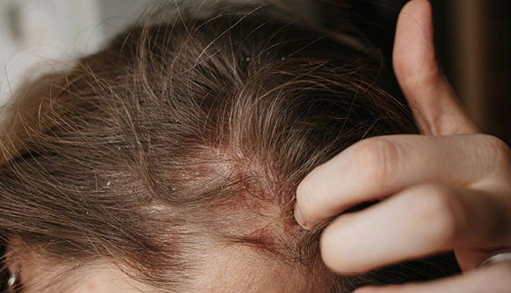 almond oil for hair,benefits of almond oil for hair,beauty tips,skin care tips