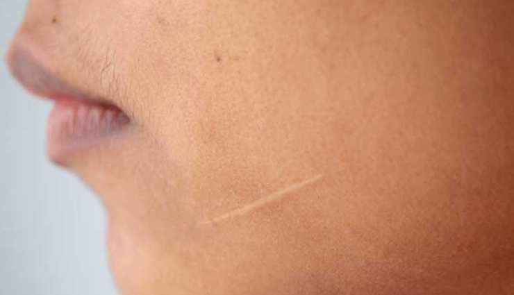 almond oil,almond oil for skin,beauty benefits of almond oil,skin care tips,beauty tips